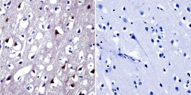 NFAT5 Antibody in Immunohistochemistry (Paraffin) (IHC (P))