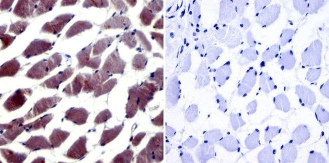 NFAT5 Antibody in Immunohistochemistry (Paraffin) (IHC (P))