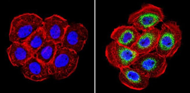 Cyclophilin B Antibody in Immunocytochemistry (ICC/IF)