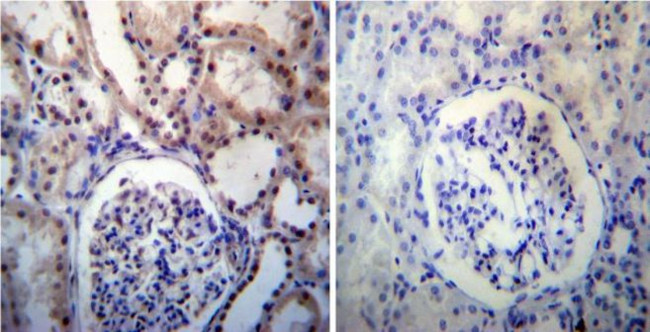 NPM1 Antibody in Immunohistochemistry (Paraffin) (IHC (P))