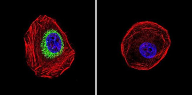 iNOS Antibody in Immunocytochemistry (ICC/IF)