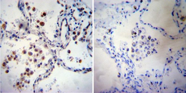 iNOS Antibody in Immunohistochemistry (Paraffin) (IHC (P))