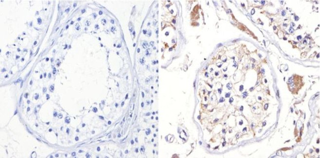 ADORA2A Antibody in Immunohistochemistry (Paraffin) (IHC (P))