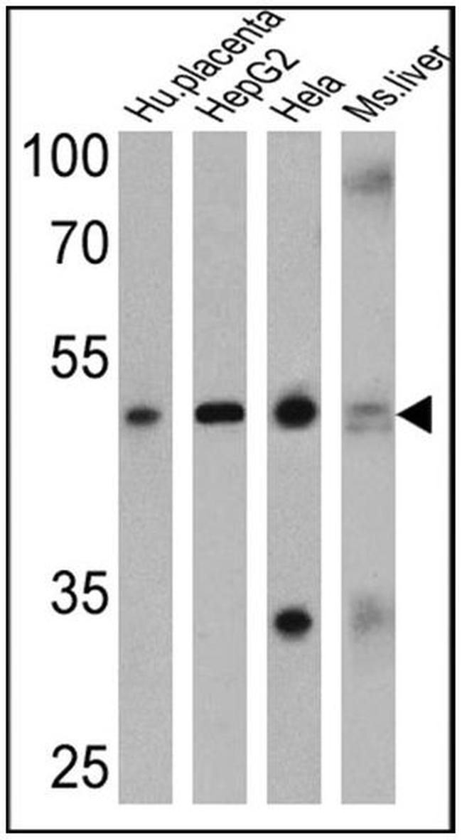 ADORA2A Antibody in Western Blot (WB)