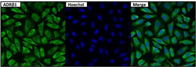 beta-1 Adrenergic Receptor Antibody in Immunocytochemistry (ICC/IF)