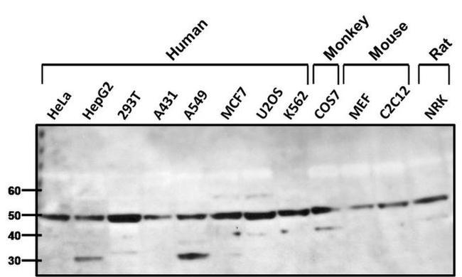 beta-1 Adrenergic Receptor Antibody in Western Blot (WB)