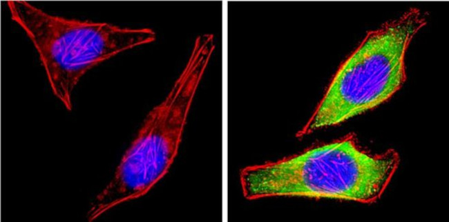 Leptin Antibody in Immunocytochemistry (ICC/IF)