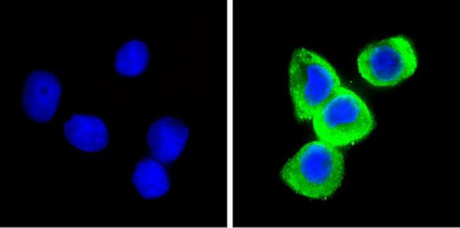 Leptin Antibody in Immunocytochemistry (ICC/IF)