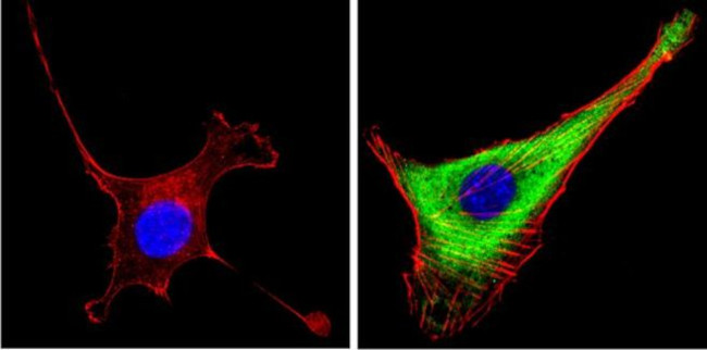 Leptin Antibody in Immunocytochemistry (ICC/IF)