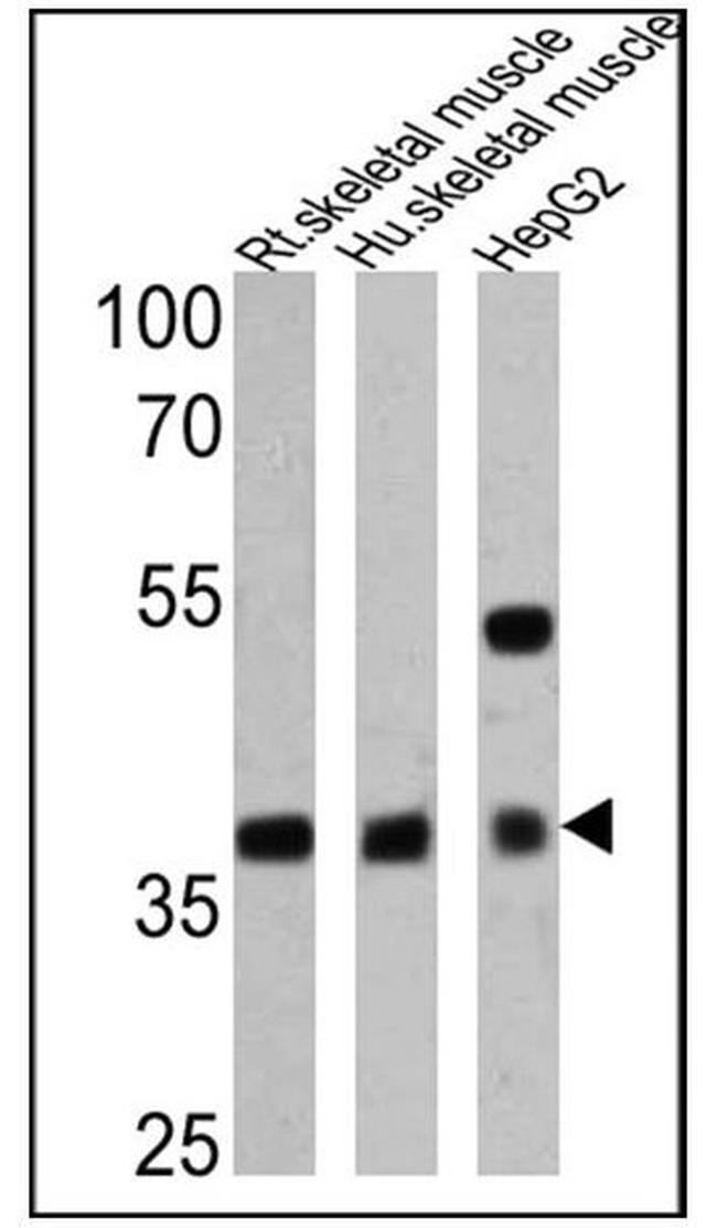 Adiponectin Receptor 1 Antibody in Western Blot (WB)