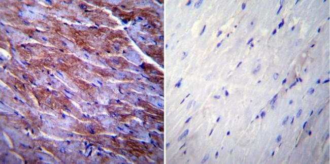 Caveolin 3 Antibody in Immunohistochemistry (Paraffin) (IHC (P))