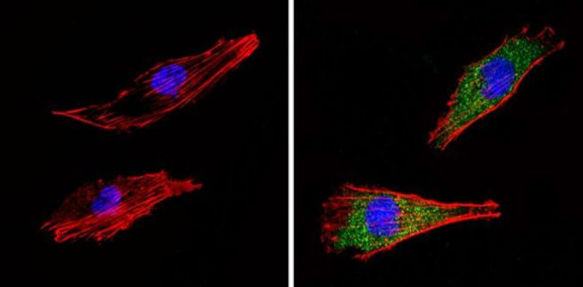 COPII Antibody in Immunocytochemistry (ICC/IF)