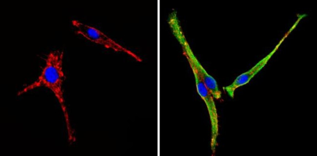 COPII Antibody in Immunocytochemistry (ICC/IF)