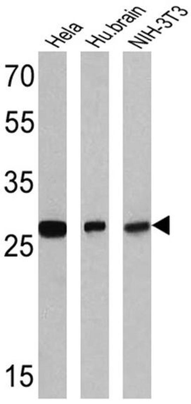 RANBP1 Antibody in Western Blot (WB)