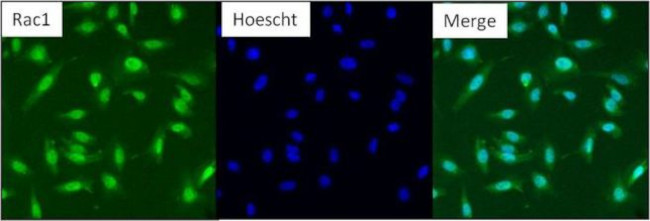 RAC1 Antibody in Immunocytochemistry (ICC/IF)