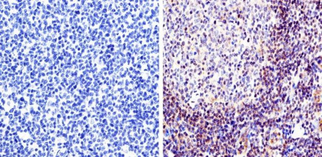 RAC1 Antibody in Immunohistochemistry (IHC)