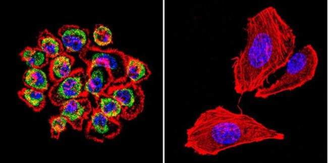 Cdc42 Antibody in Immunocytochemistry (ICC/IF)