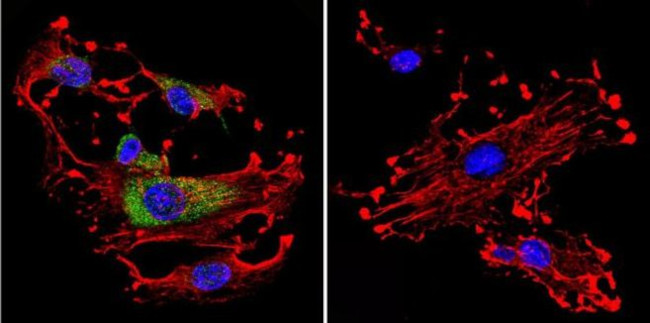 Cdc42 Antibody in Immunocytochemistry (ICC/IF)