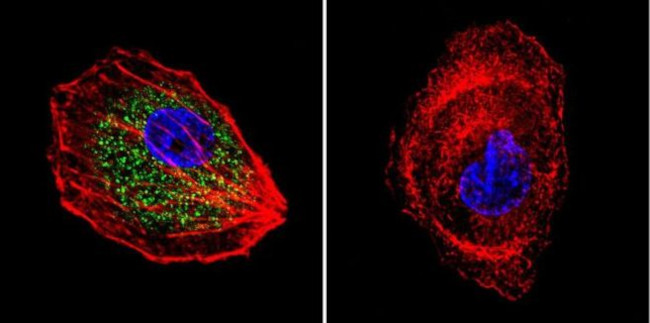 Cdc42 Antibody in Immunocytochemistry (ICC/IF)