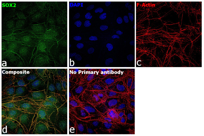 SOX2 Antibody in Immunocytochemistry (ICC/IF)