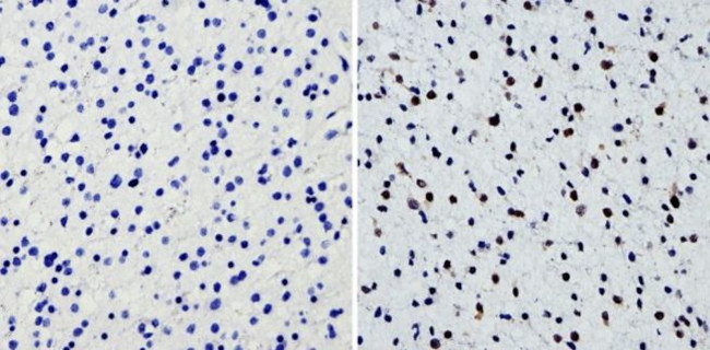 SOX2 Antibody in Immunohistochemistry (Paraffin) (IHC (P))