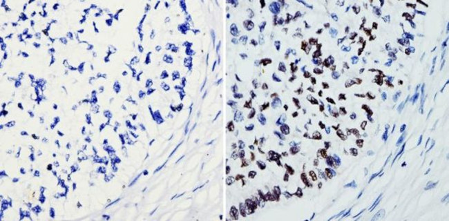 SOX2 Antibody in Immunohistochemistry (Paraffin) (IHC (P))