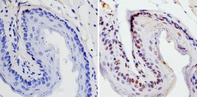 SOX2 Antibody in Immunohistochemistry (Paraffin) (IHC (P))