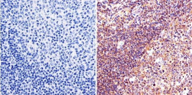 LIN28A Antibody in Immunohistochemistry (IHC)