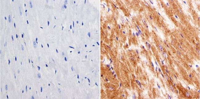 LIN28A Antibody in Immunohistochemistry (IHC)