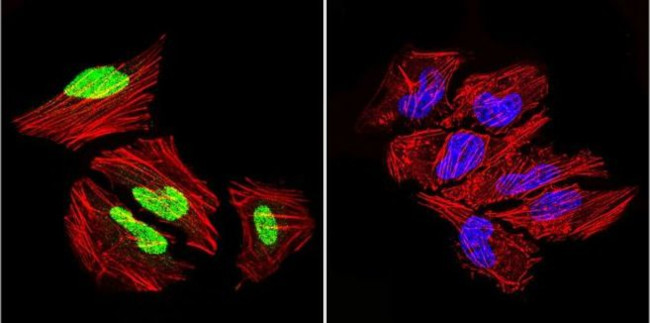 GATA1 Antibody in Immunocytochemistry (ICC/IF)