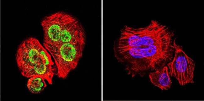 GATA1 Antibody in Immunocytochemistry (ICC/IF)