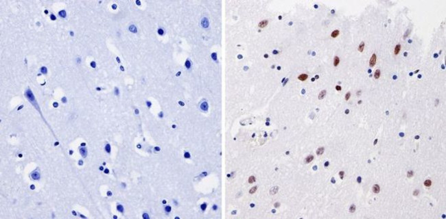 GATA1 Antibody in Immunohistochemistry (Paraffin) (IHC (P))