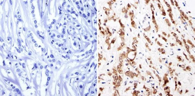 GATA1 Antibody in Immunohistochemistry (Paraffin) (IHC (P))