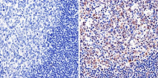 GATA1 Antibody in Immunohistochemistry (Paraffin) (IHC (P))