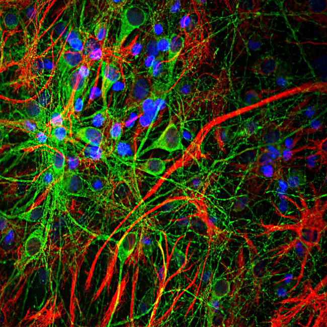 GFAP Antibody in Immunocytochemistry (ICC/IF)