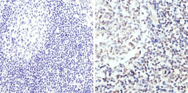 GATA3 Antibody in Immunohistochemistry (Paraffin) (IHC (P))