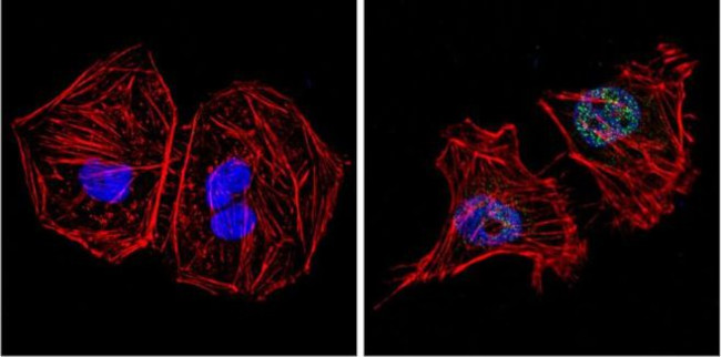 GATA4 Antibody in Immunocytochemistry (ICC/IF)