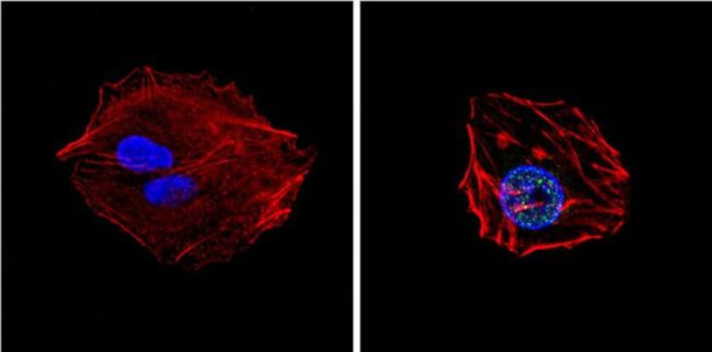 GATA4 Antibody in Immunocytochemistry (ICC/IF)