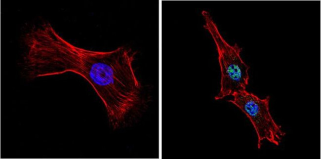 GATA4 Antibody in Immunocytochemistry (ICC/IF)