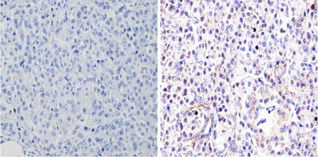 GATA4 Antibody in Immunohistochemistry (Paraffin) (IHC (P))