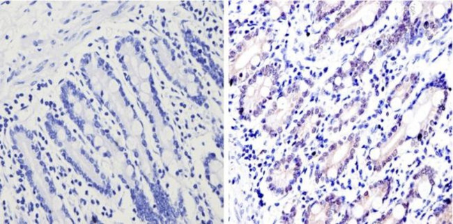 GATA4 Antibody in Immunohistochemistry (Paraffin) (IHC (P))