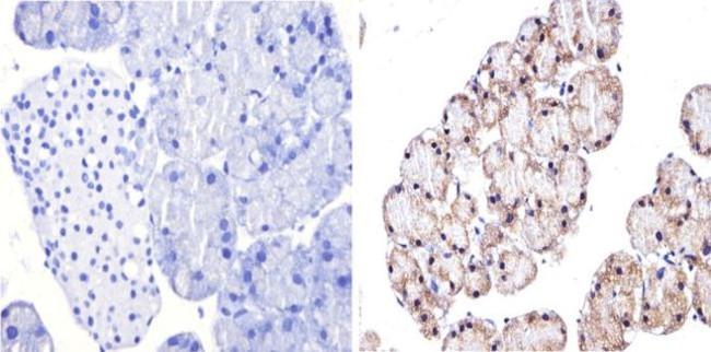 GATA4 Antibody in Immunohistochemistry (Paraffin) (IHC (P))