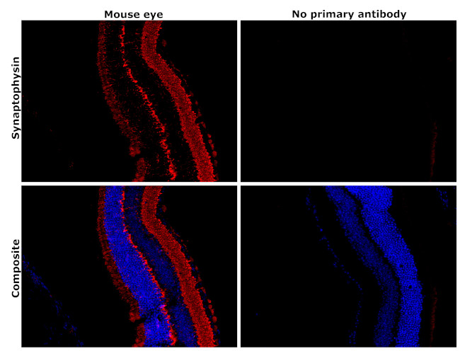 Synaptophysin Antibody in Immunohistochemistry (Paraffin) (IHC (P))