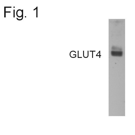 GLUT4 Antibody in Western Blot (WB)