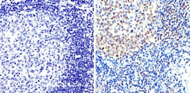 PAX5 Antibody in Immunohistochemistry (Paraffin) (IHC (P))