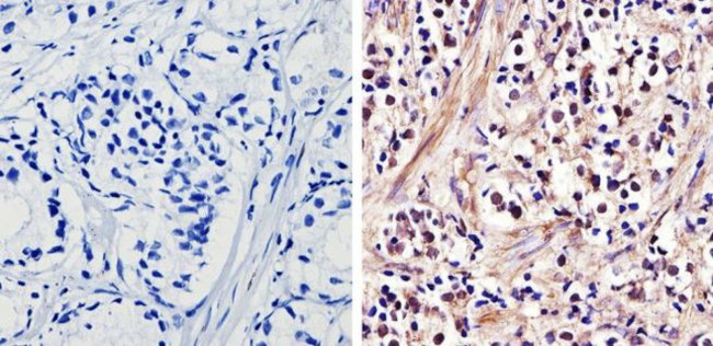 Androgen Receptor Antibody in Immunohistochemistry (Paraffin) (IHC (P))