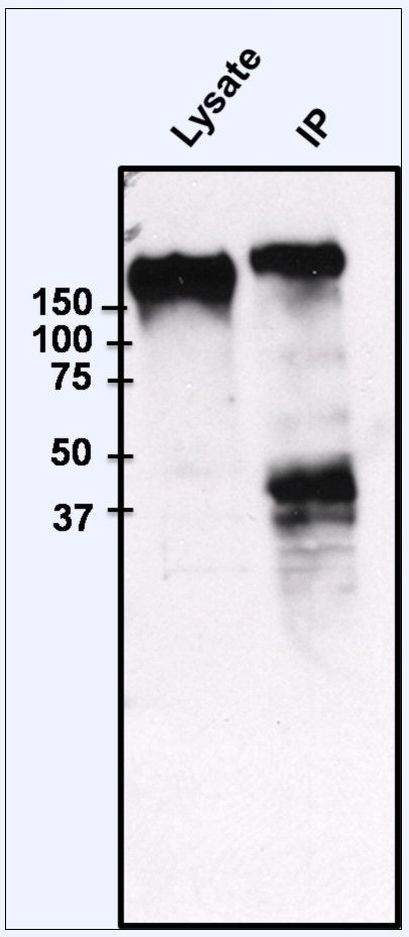 EGFR Antibody in Immunoprecipitation (IP)