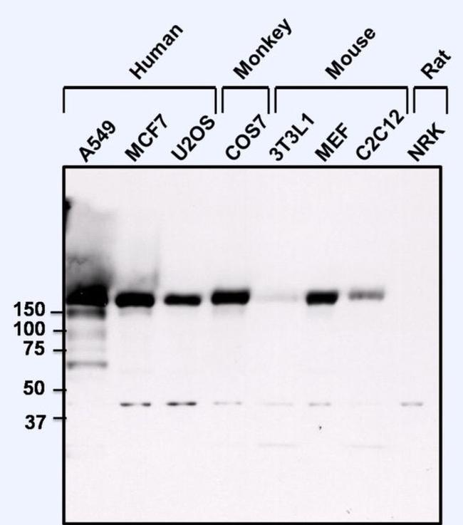 EGFR Antibody in Western Blot (WB)