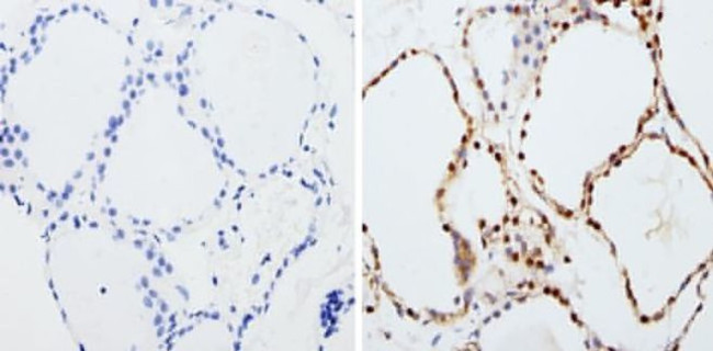 PAX8 Antibody in Immunohistochemistry (Paraffin) (IHC (P))