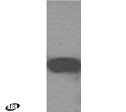 SGPP2 Antibody in Western Blot (WB)